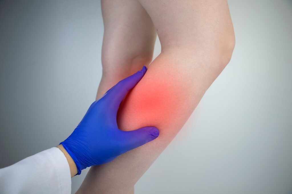 Red Light Therapy for Restless Legs Syndrome