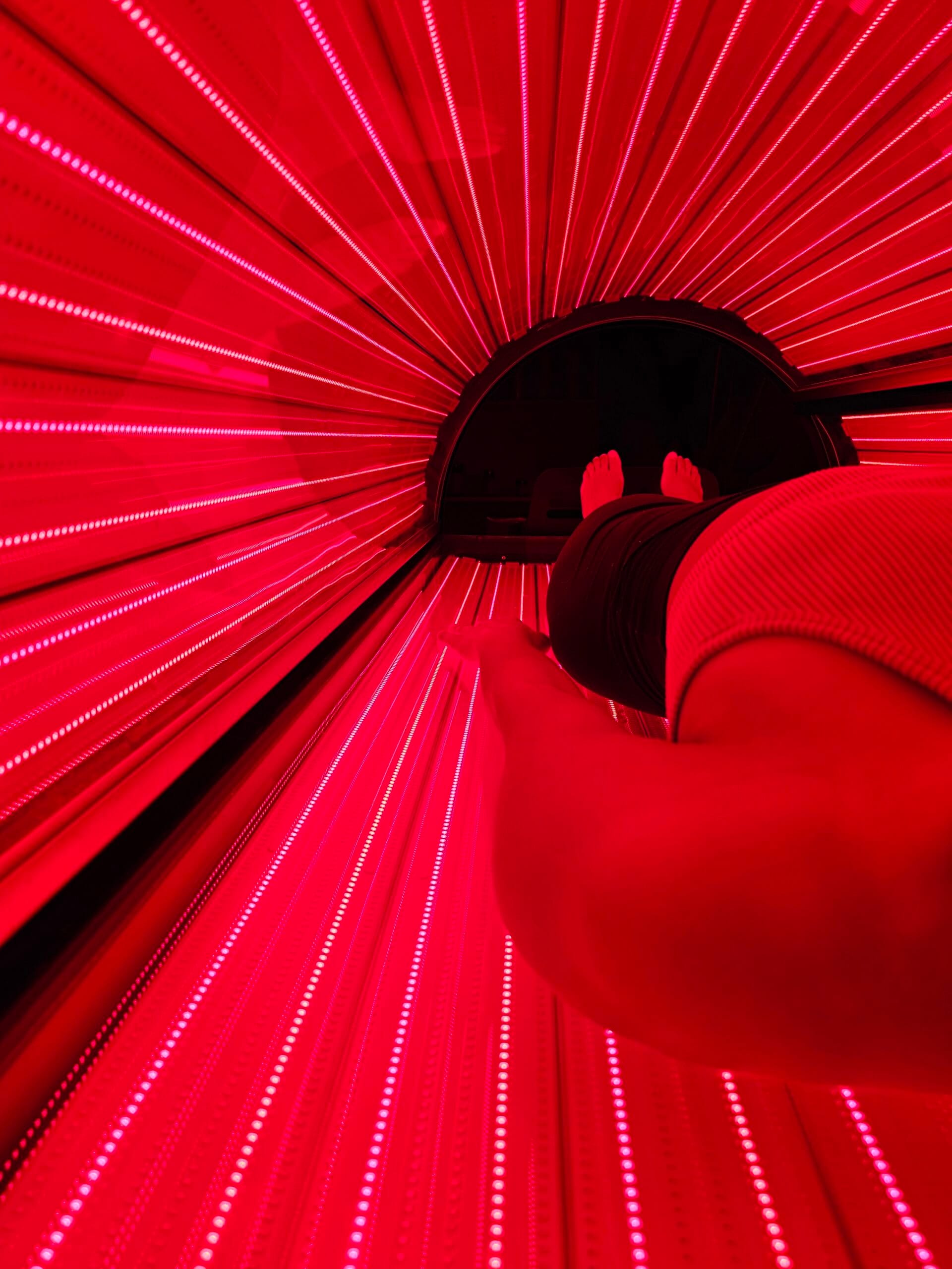 Benefits of Red Light Therapy for Burn Recovery